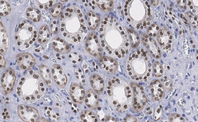 Anti-HNF-1β Antibody, clone 1M22 ZooMAb<sup>®</sup> Rabbit Monoclonal
