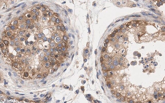 Anti-mTOR Antibody, clone 4O5 ZooMAb<sup>®</sup> Rabbit Monoclonal
