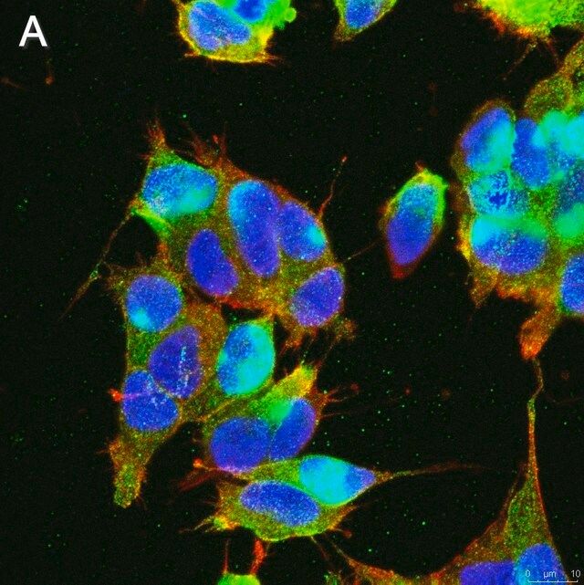 Anti-GABA A Receptor α1 Antibody, clone 3H10 ZooMAb<sup>®</sup> Rabbit Monoclonal