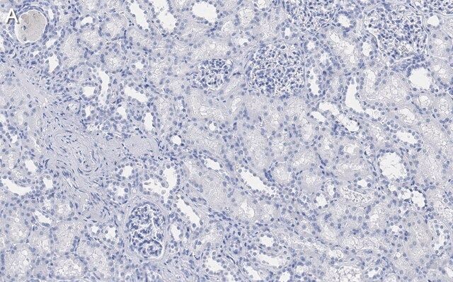 Anti-DIP2B Antibody, clone 2C8, ZooMAb<sup>®</sup> Rabbit Monoclonal