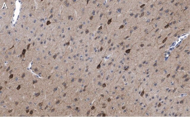 Anti-GluR1 Antibody, clone RH95 ZooMAb<sup>®</sup> Mouse Monoclonal