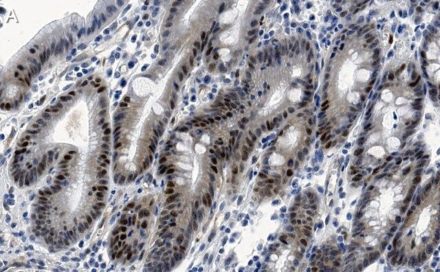 Anti-E2F-1 Antibody, clone 1H21 ZooMAb<sup>®</sup> Rabbit Monoclonal
