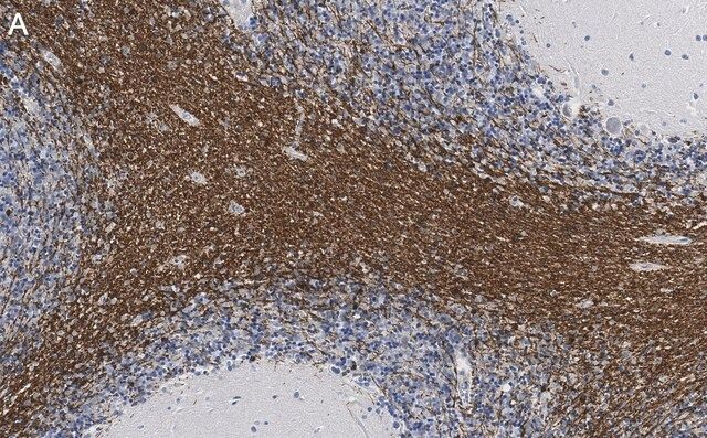 Anti-CNPase Antibody, clone 3N12 ZooMAb<sup>®</sup> Rabbit Monoclonal