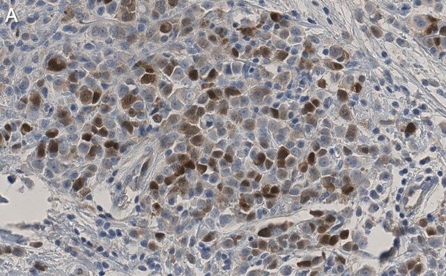 Anti-CDK1/CDC2 Antibody, clone 1J8 ZooMAb<sup>®</sup> Rabbit Monoclonal