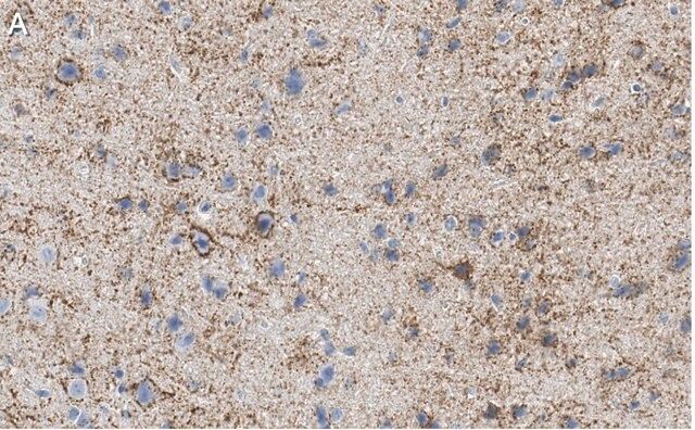 Anti-GAD67 Antibody, clone 1G10.2 ZooMAb<sup>®</sup> Mouse Monoclonal