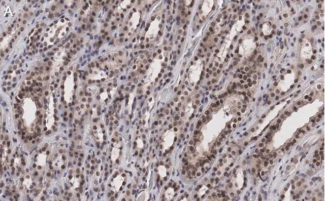 Anti-MLL/HRX CT Antibody, clone 5C15 ZooMAb<sup>®</sup> Rabbit Monoclonal