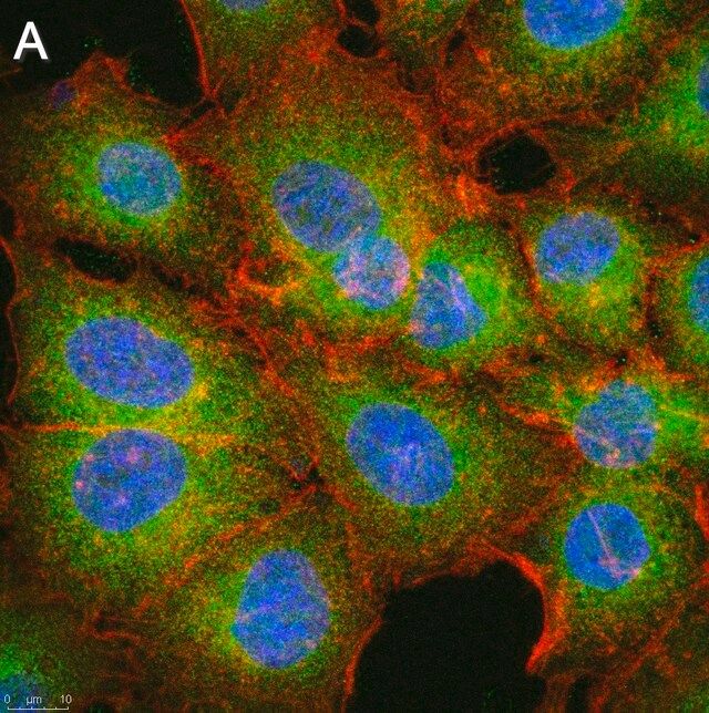 Anti-MCU Antibody, clone 3N3 ZooMAb<sup>®</sup> Rabbit Monoclonal