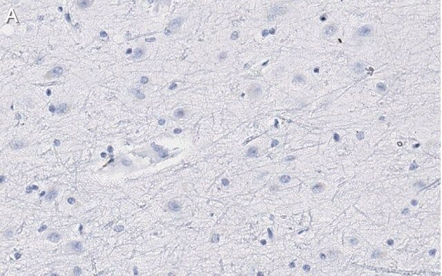 Anti-Neurogranin Antibody, clone 1D4 , ZooMAb<sup>®</sup> Rabbit Monoclonal