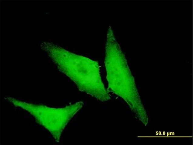 Monoclonal Anti-HSPB1 antibody produced in mouse
