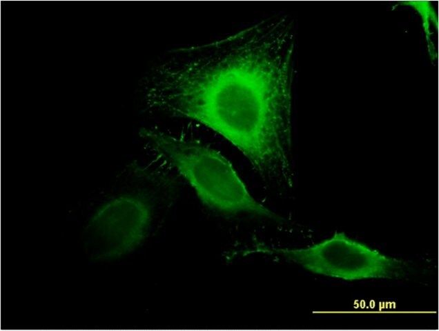 Monoclonal Anti-MIR16 antibody produced in mouse