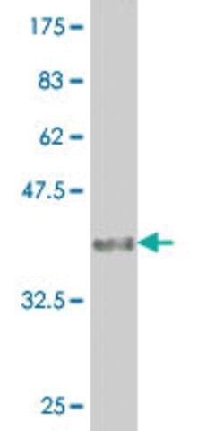 Monoclonal Anti-CER1 antibody produced in mouse