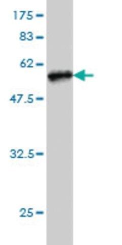 Monoclonal Anti-TREM1 antibody produced in mouse