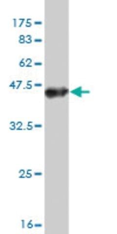 Monoclonal Anti-TTYH1 antibody produced in mouse