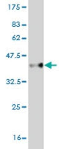 Monoclonal Anti-CBX2 antibody produced in mouse