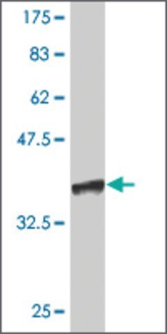 Monoclonal Anti-CFDP1 antibody produced in mouse