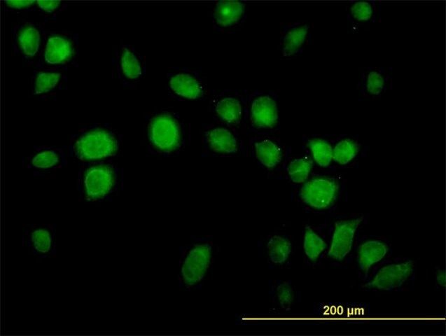 Monoclonal Anti-USP14 antibody produced in mouse