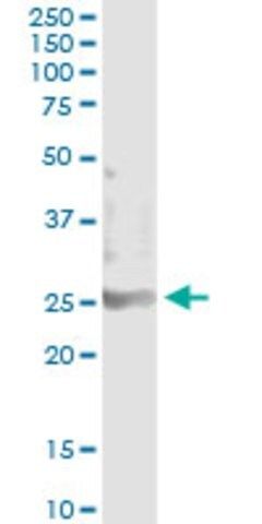 Monoclonal Anti-TEB1 antibody produced in mouse