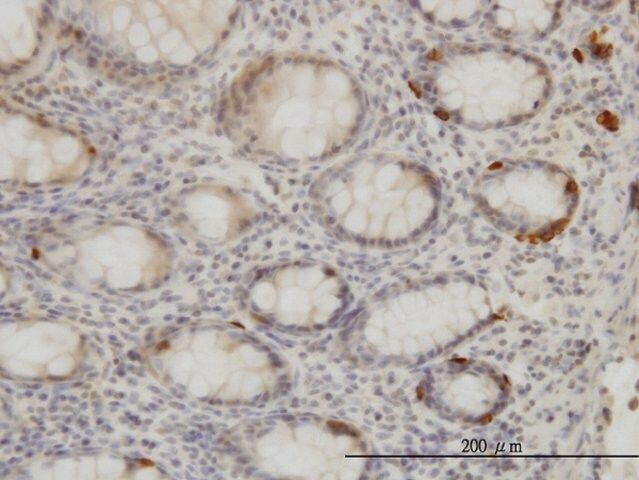 Monoclonal Anti-TRIB2 antibody produced in mouse