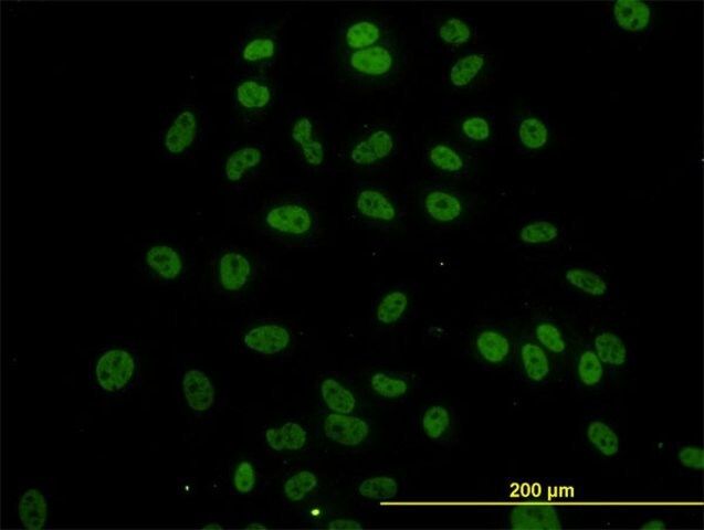 Monoclonal Anti-SURB7 antibody produced in mouse