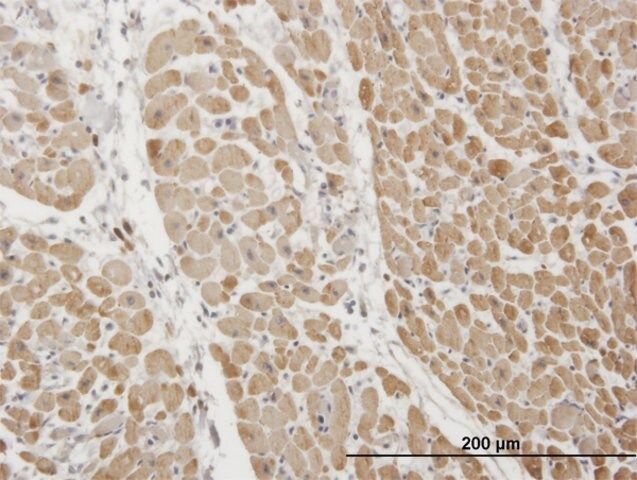 Monoclonal Anti-TNNI3 antibody produced in mouse