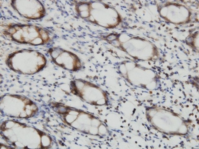 Monoclonal Anti-RALB antibody produced in mouse