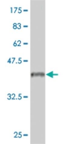 Monoclonal Anti-IL18RAP antibody produced in mouse