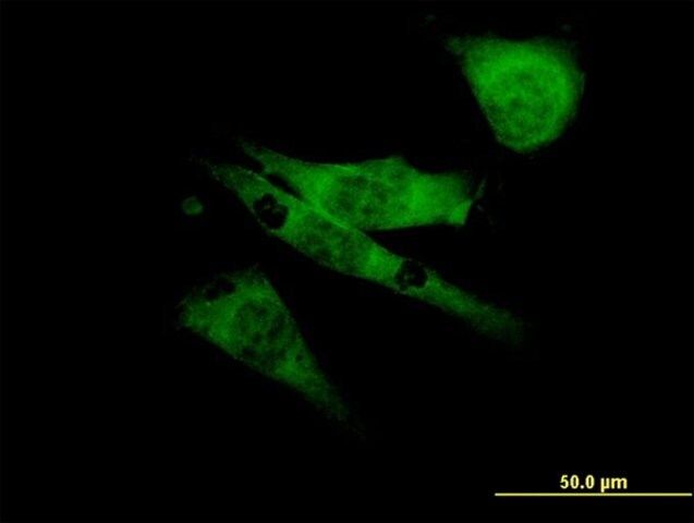 Monoclonal Anti-SCN8A antibody produced in mouse