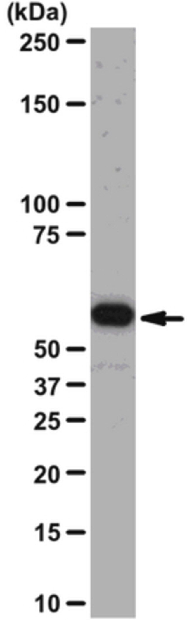 Anti-Akt1/PKBα Antibody, clone AW24 | 04-796