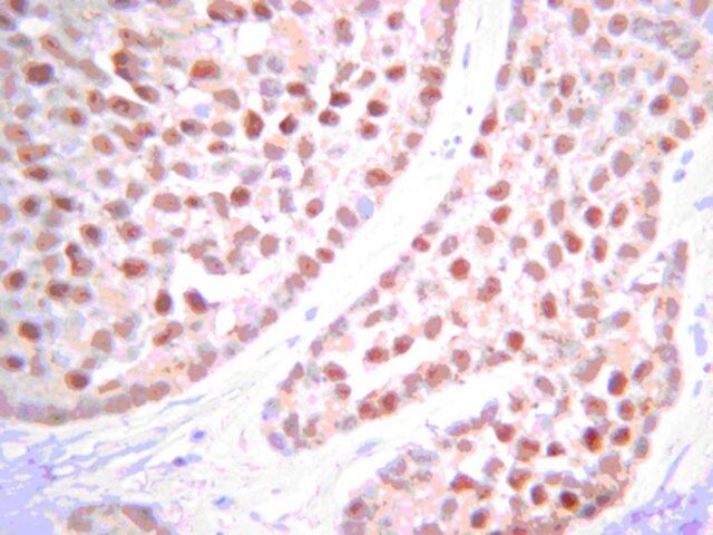 Anti-PTEN Antibody, clone 6H2.1