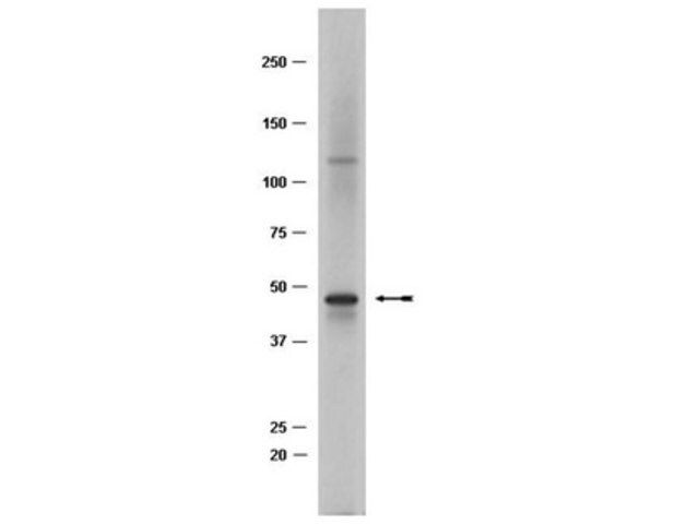 Anti-TAL-1 Antibody, clone BTL73