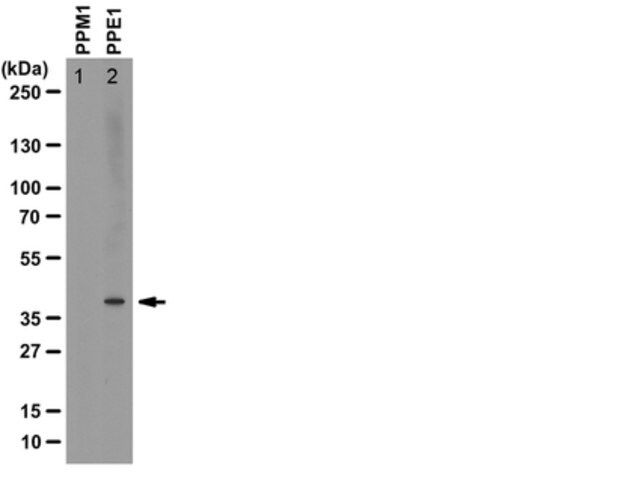 Anti-methyl-PP2A Antibody, C subunit, clone 2A10