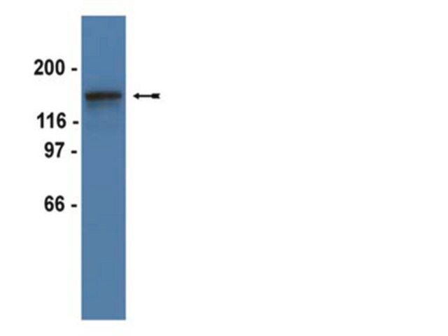 Anti-PDGFRβ Antibody, clone 4A56, rabbit monoclonal