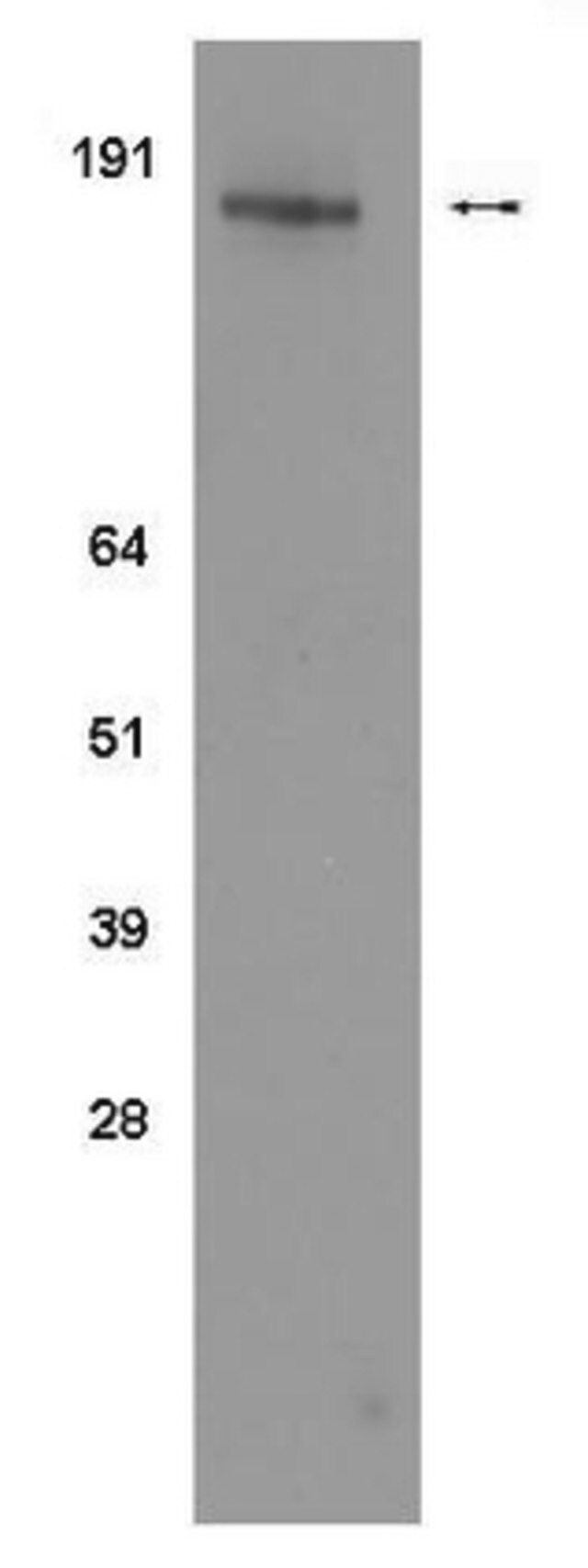 Anti-phosho-erbB2/Her2 (Tyr1112) Antibody, clone 19G5