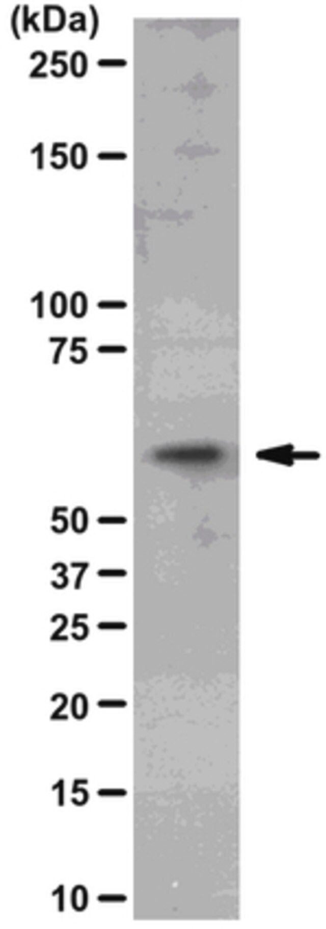 Anti-Akt2/PKBβ Antibody, clone AW114, rabbit monoclonal