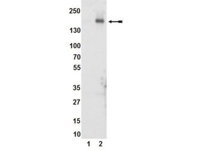 Anti-phospho-KDR/Flk-1/VEGFR2 (Tyr1054) Antibody, clone D1W, rabbit monoclonal