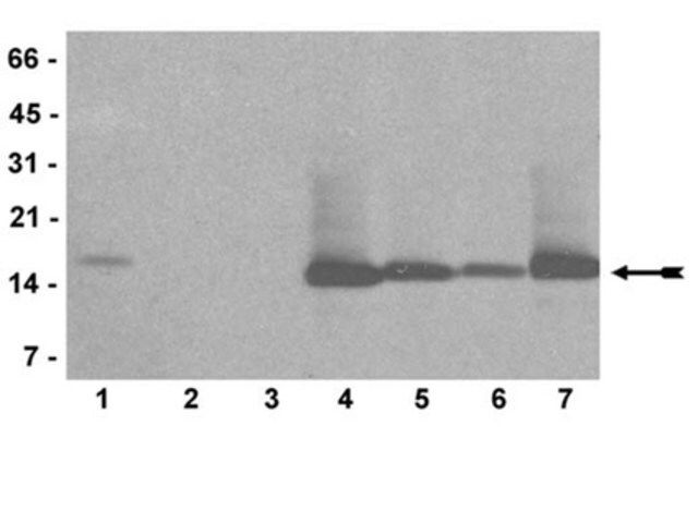 Anti-mono/di/trimethyl-Histone H3 (Lys4) Antibody, clone AW304, rabbit monoclonal
