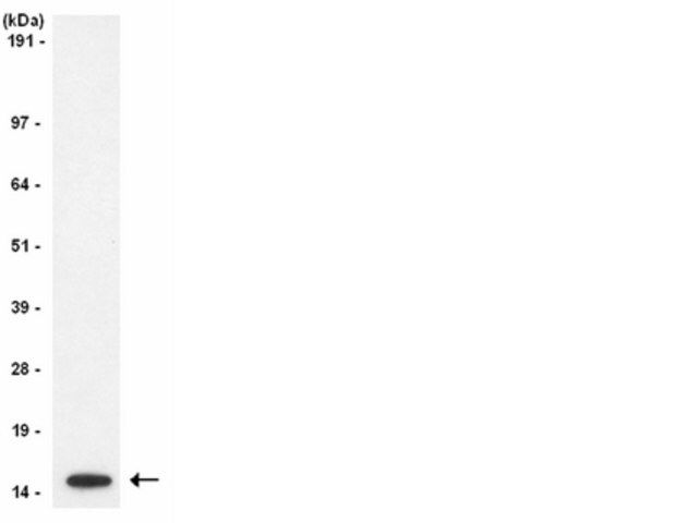Anti-Histone H3 Antibody, CT, pan, clone A3S, rabbit monoclonal