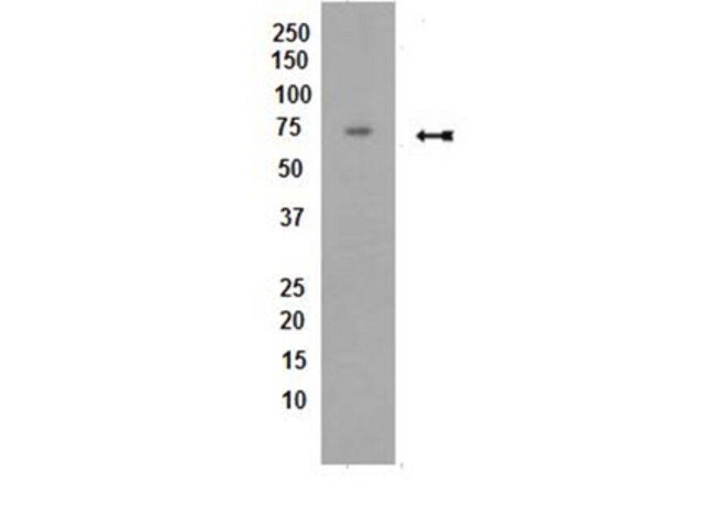 Anti-PP2A Antibody, B subunit, B56 delta, clone H5D12