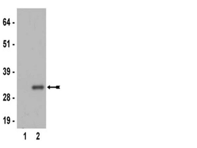 Anti-phospho-Ribosomal Protein S6 (Ser235) Antibody, clone MC27, rabbit monoclonal