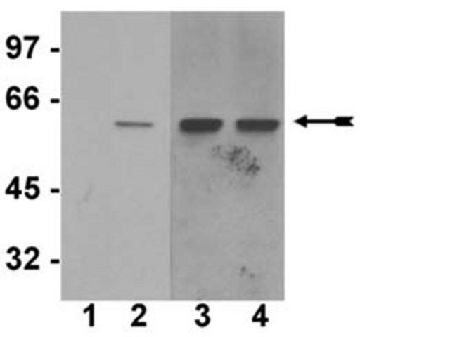 Anti-phospho-Akt1/PKBα (Ser473) Antibody, clone SK703, rabbit monoclonal