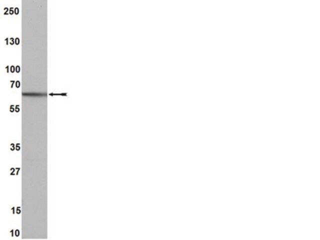 Anti-Estrogen Receptor β Antibody, clone 68-4, rabbit monoclonal