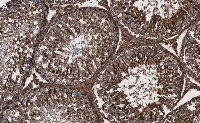 Anti-Actin Antibody, clone C4 ZooMAb<sup>®</sup> Mouse Monoclonal