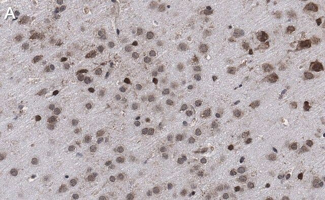 Anti-AFF2 Antibody, clone 1G13 ZooMAb<sup>®</sup> Rabbit Monoclonal