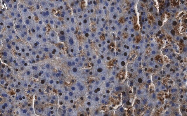 Anti-Arginase-1 Antibody, clone 3B17 ZooMAb<sup>®</sup> Rabbit Monoclonal