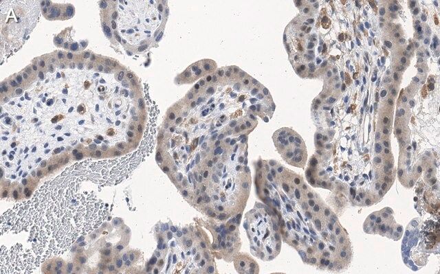 Anti-ATG7 Antibody, clone 1E15 ZooMAb<sup>®</sup> Rabbit Monoclonal
