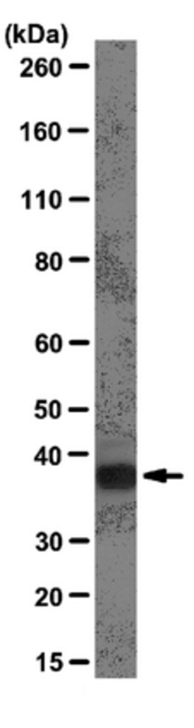 Anti-hnRNP A1 Antibody, clone 9H10
