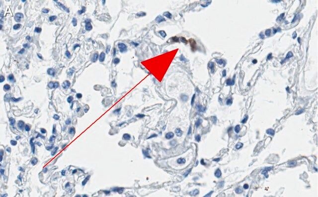 Anti-ACE2-cytoplasmic Antibody, clone 1C17 ZooMAb<sup>®</sup> Rabbit Monoclonal