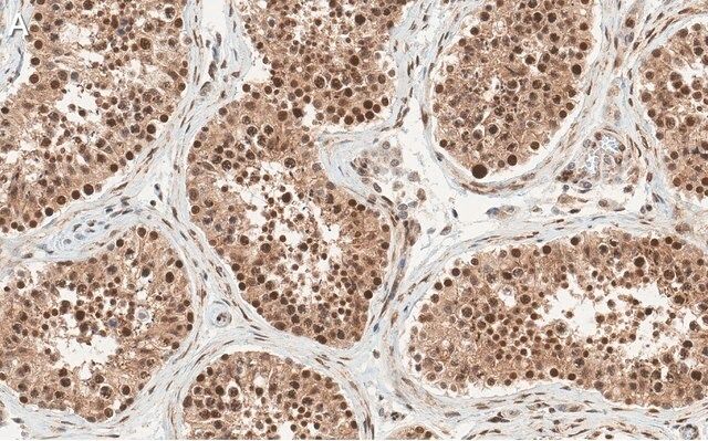 Anti-Anillin Antibody, clone 2C6 ZooMAb<sup>®</sup> Rabbit Monoclonal