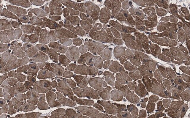 Anti-CACNA1C Antibody, clone 1F20 ZooMAb<sup>®</sup> Rabbit Monoclonal