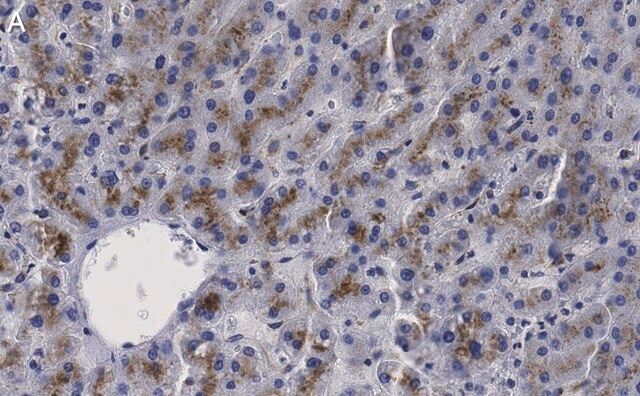 Anti-β-Glucocerebrosidase Antibody, clone 2I15 ZooMAb<sup>®</sup> Rabbit Monoclonal